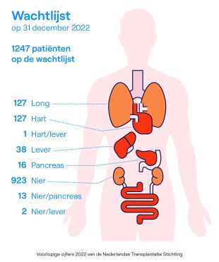 Jaarcijfers 2022: Hoogste Aantal Orgaandonoren In één Jaar 