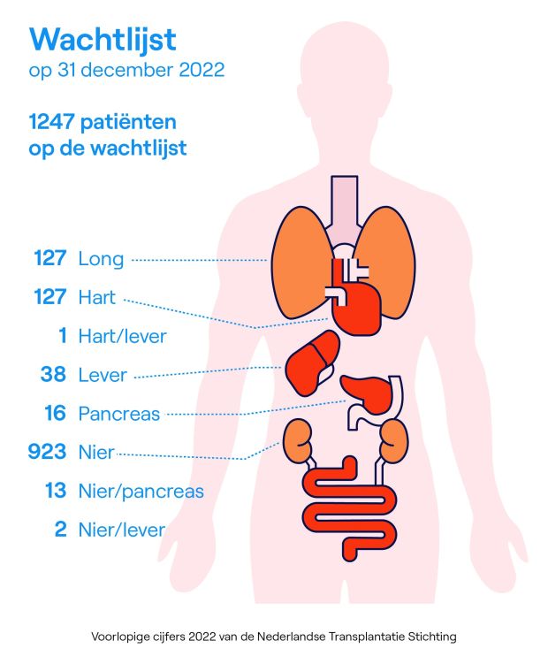 Wachtlijsten orgaantransplantatie jaarcijfers 2022