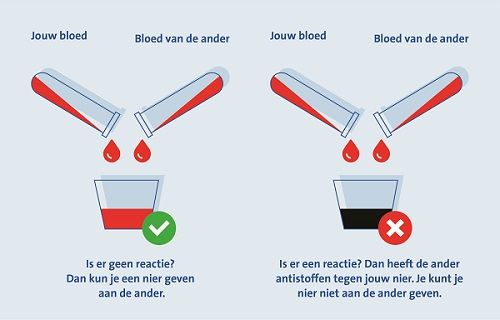 Hier ziet u een plaatje van antistoffen.